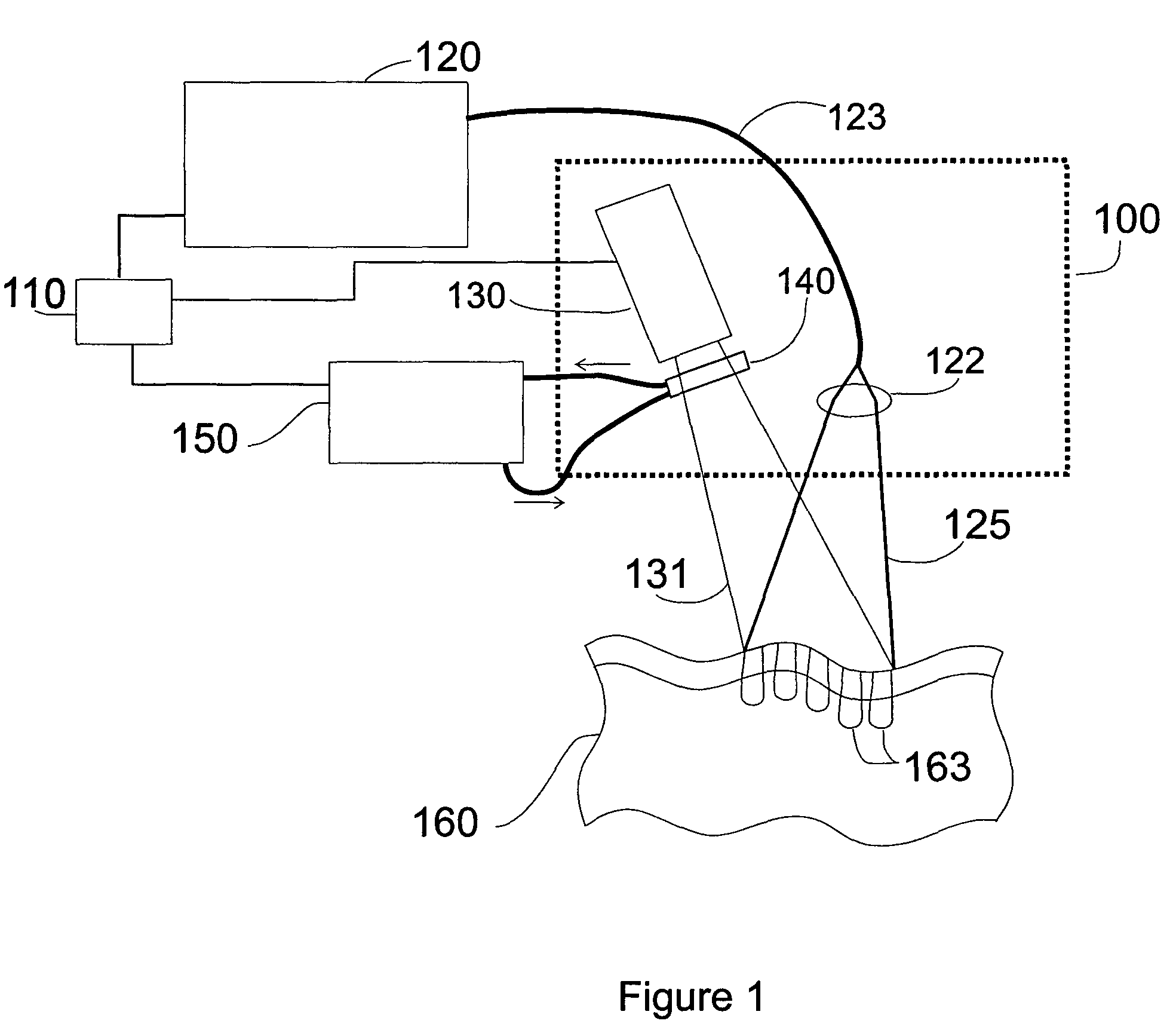 Patterned thermal treatment using patterned cryogen spray and irradiation by light