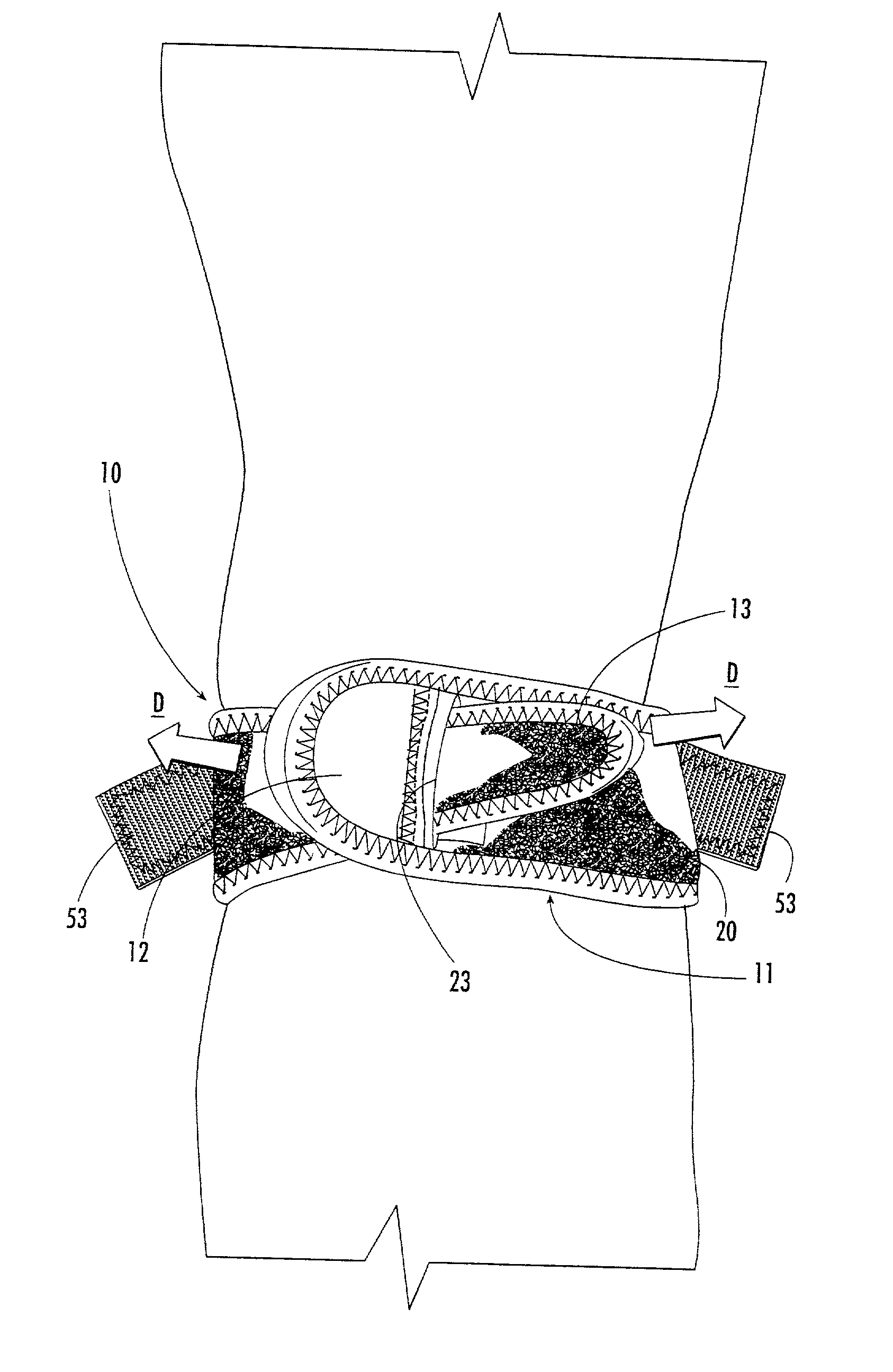 Adjustable support device for the knee