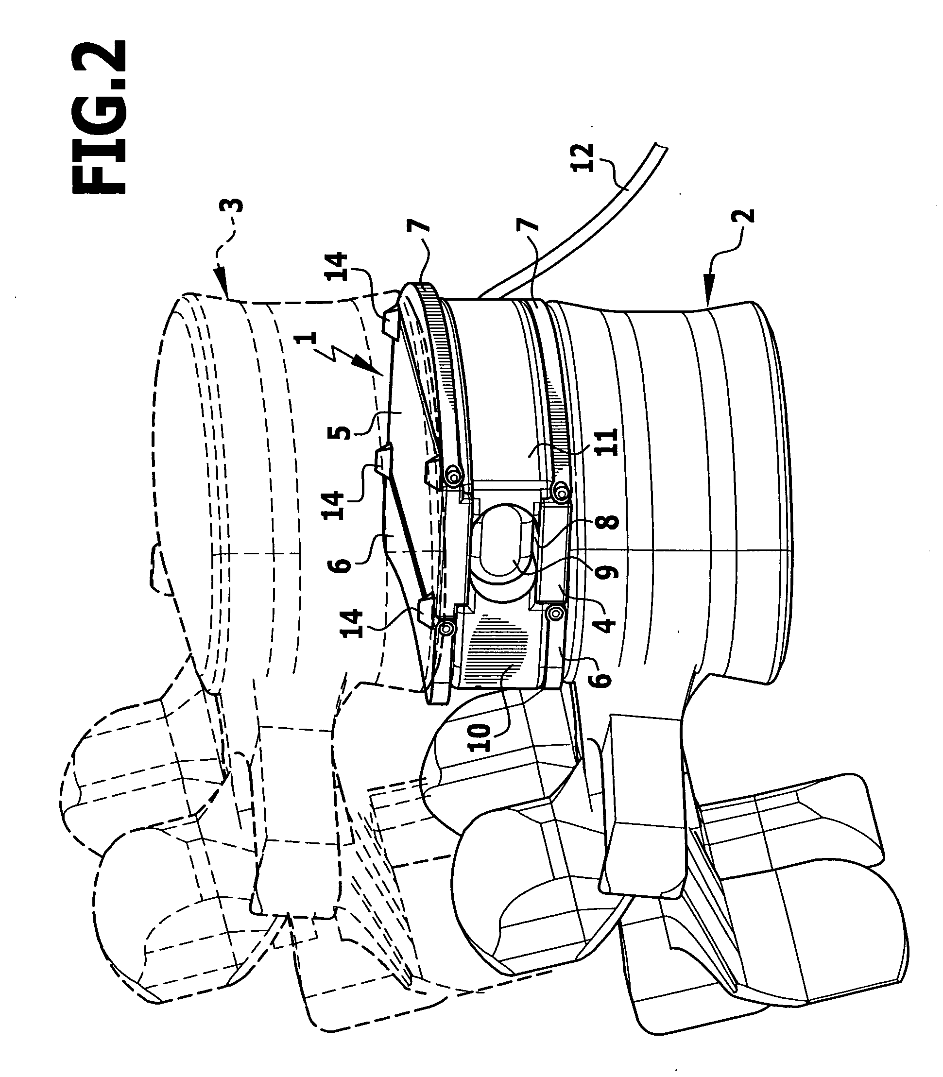 Intervertebral implant