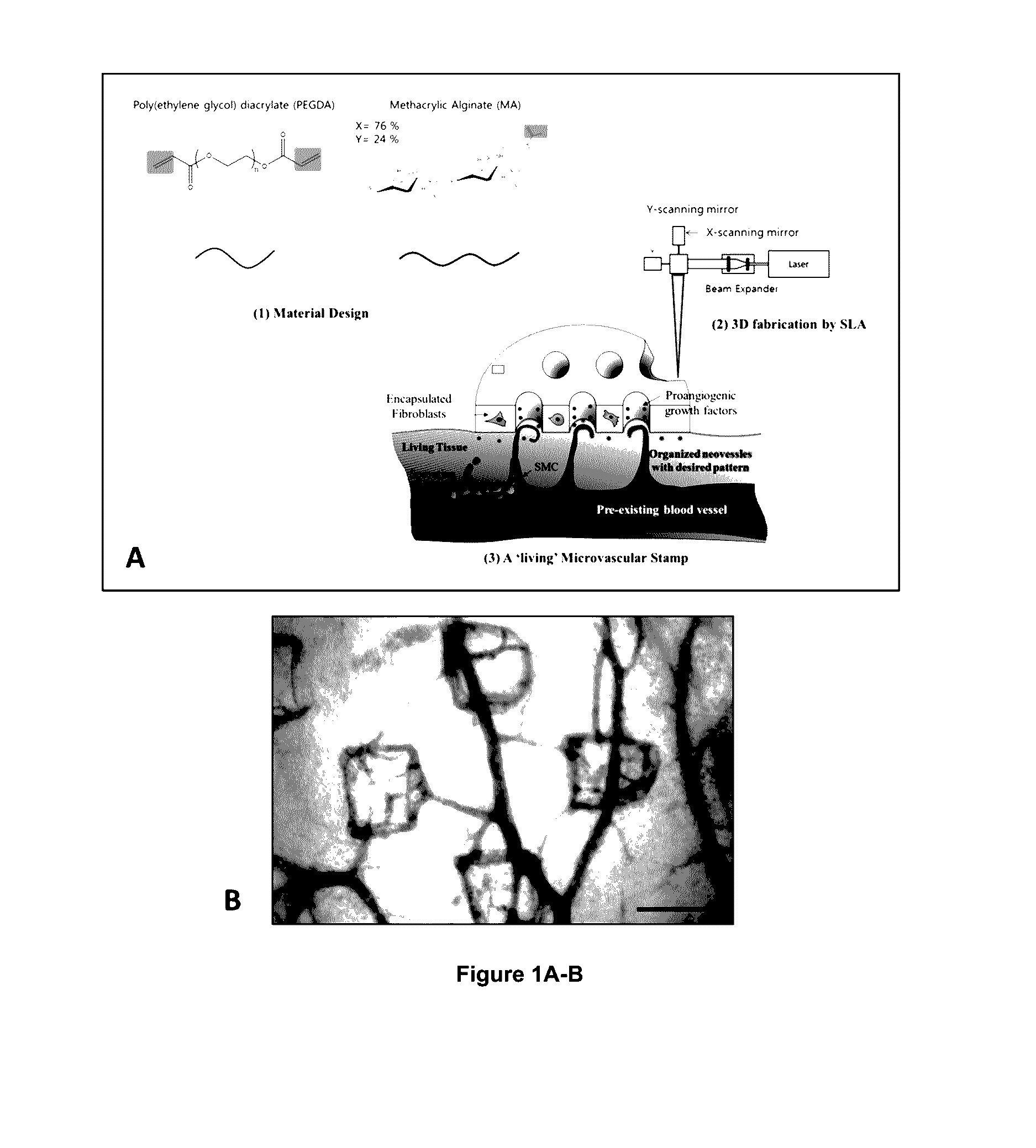 Microvascular stamp for patterning of functional neovessels