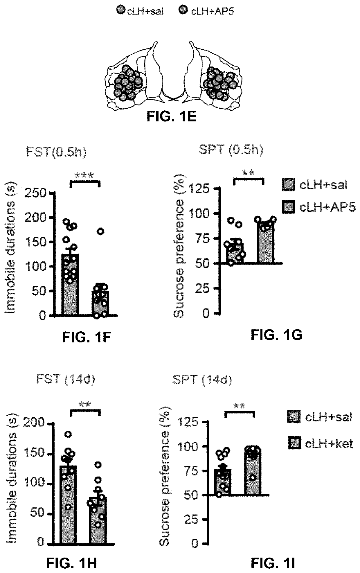 Method and pharmaceutical composition for treating depression