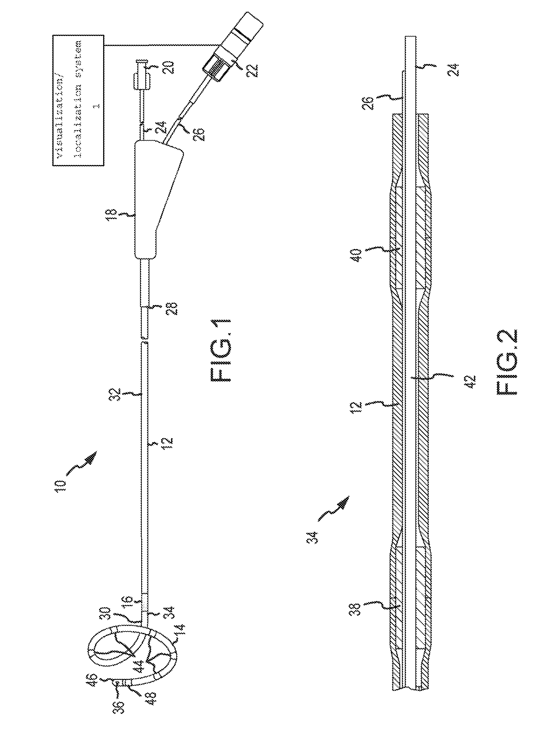 Movable magnet for magnetically guided catheter