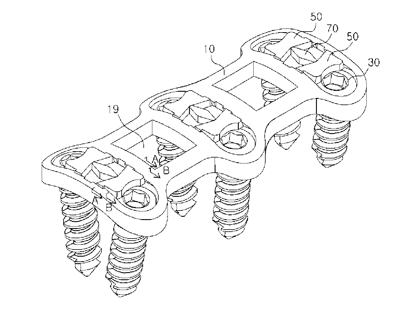 Spine fixing apparatus