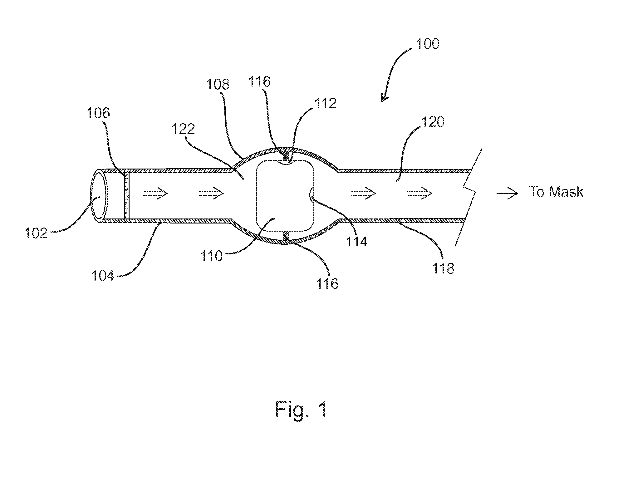 Systems and methods for providing positive airway pressure in a tube-like structure