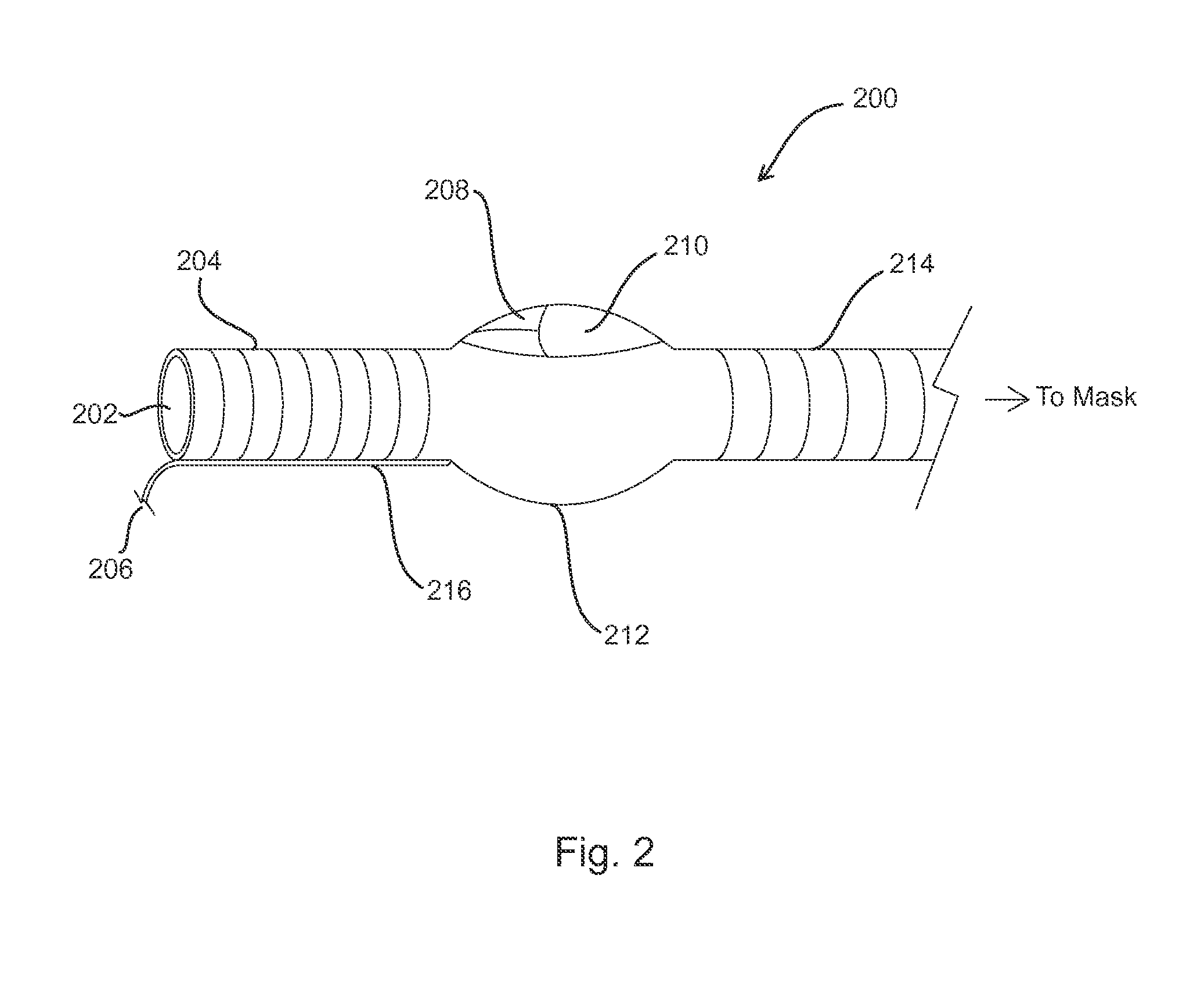 Systems and methods for providing positive airway pressure in a tube-like structure