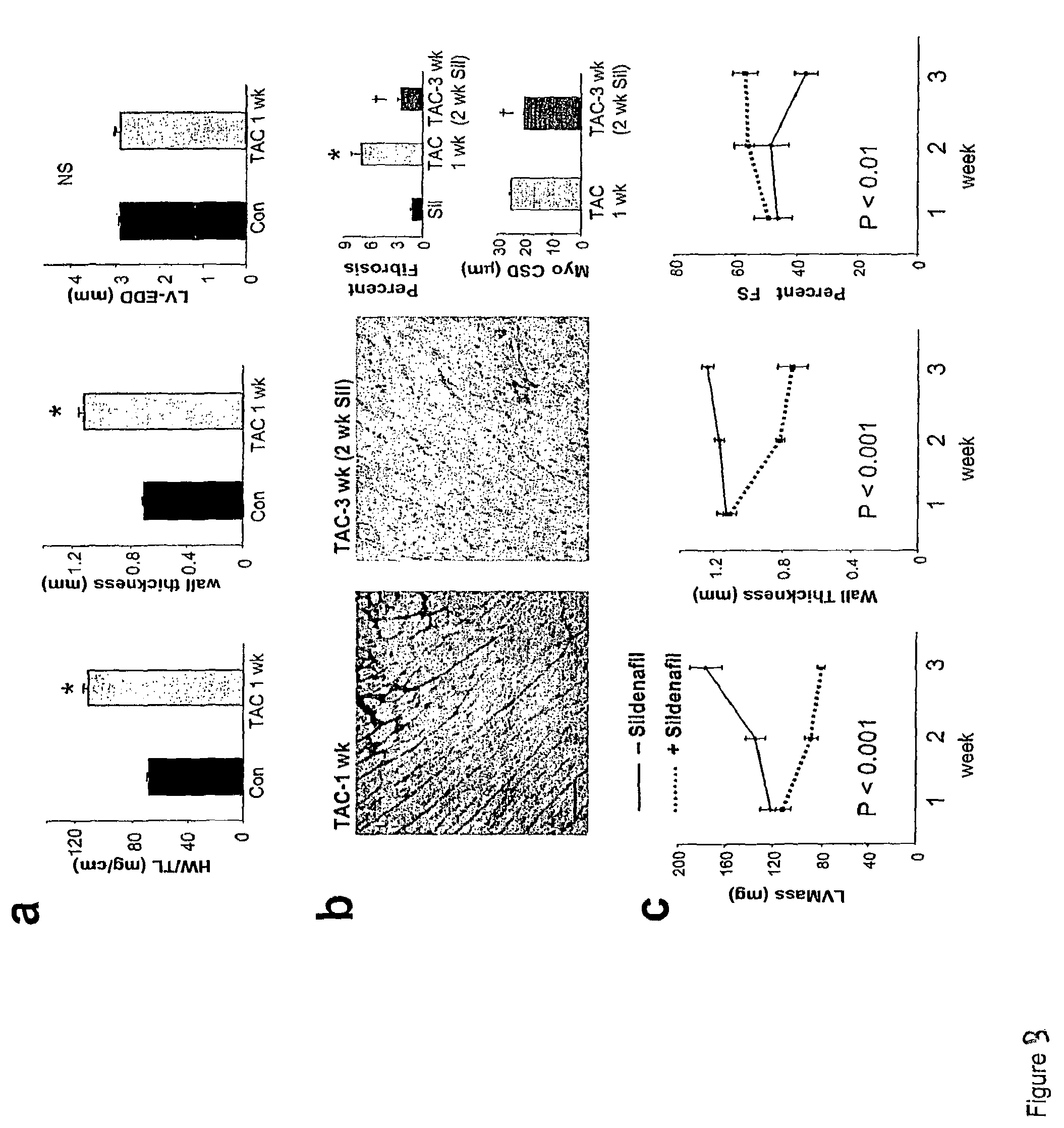 PDE5 inhibitor compositions and methods for treating cardiac indications