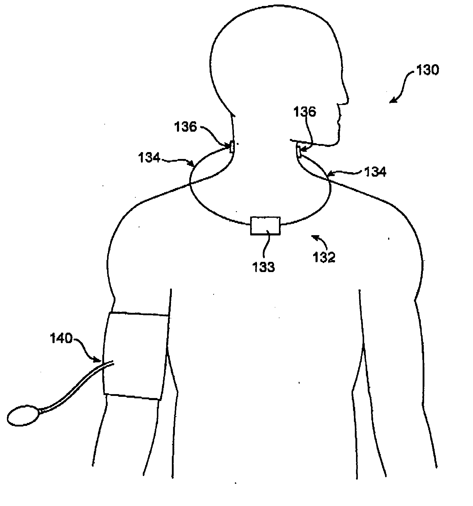 External baroreflex activation