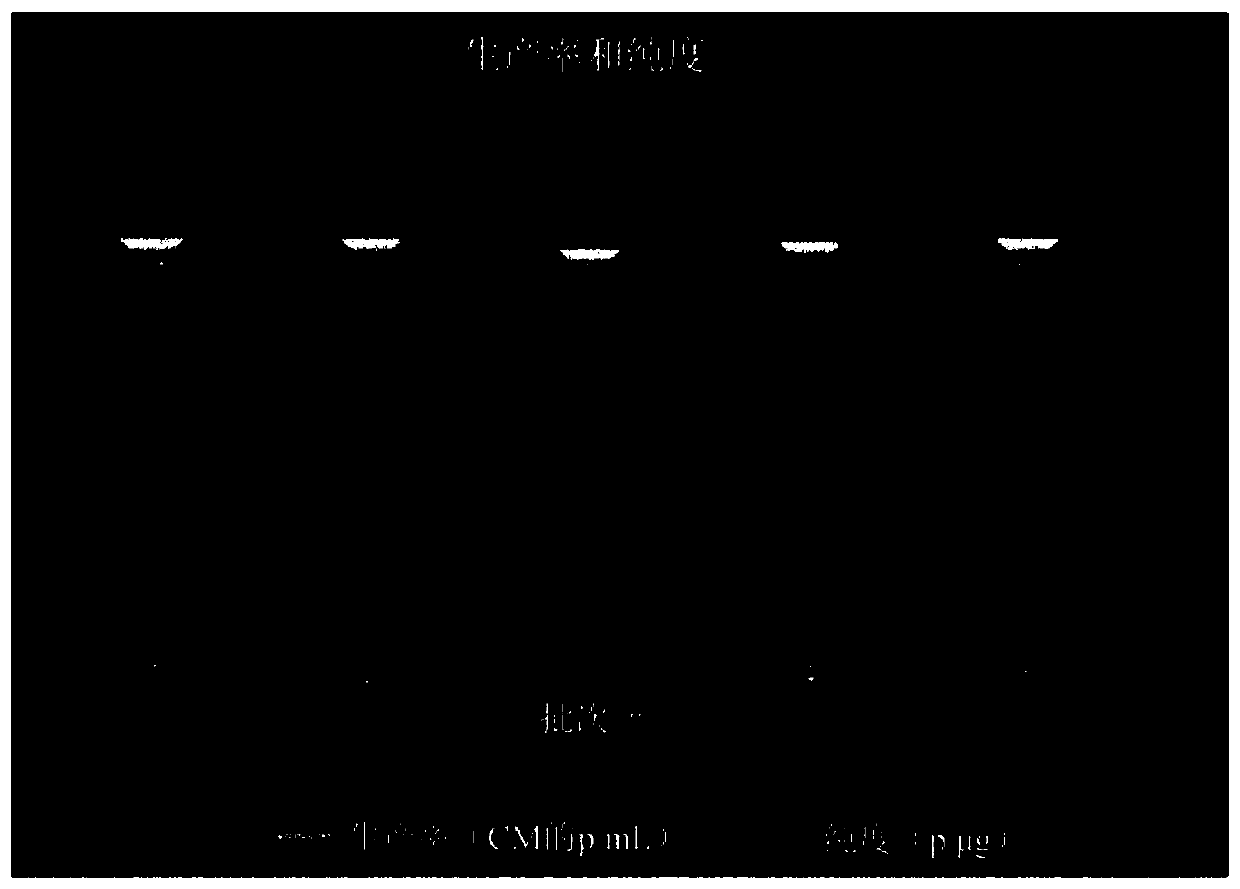 Use of composition comprising stem cell-derived exosome as effective ingredient for prevention or alleviation of pruritus