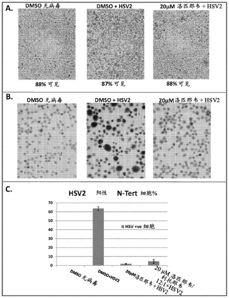 Compositions comprising lopinavir and treatment of conditions