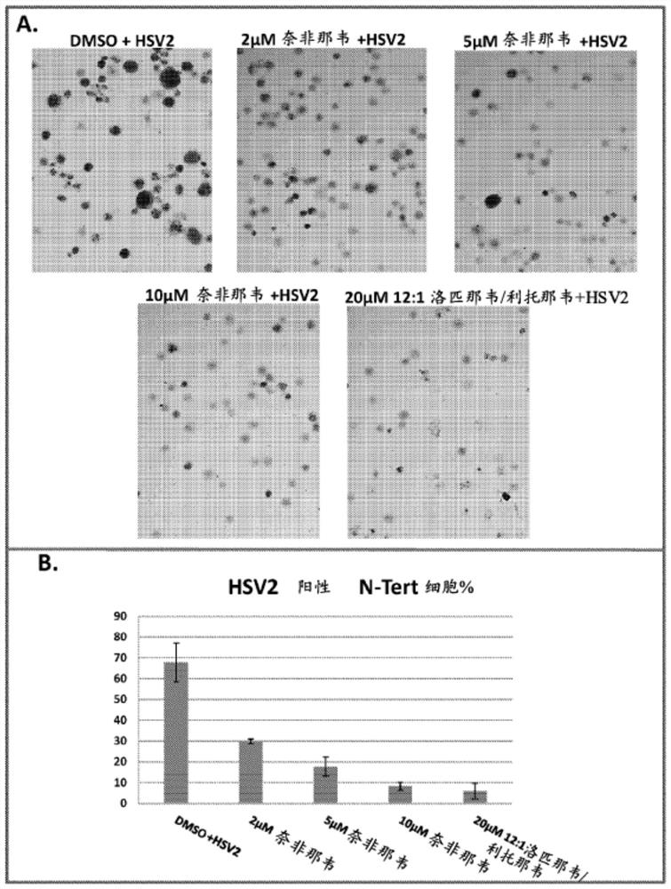 Compositions comprising lopinavir and treatment of conditions