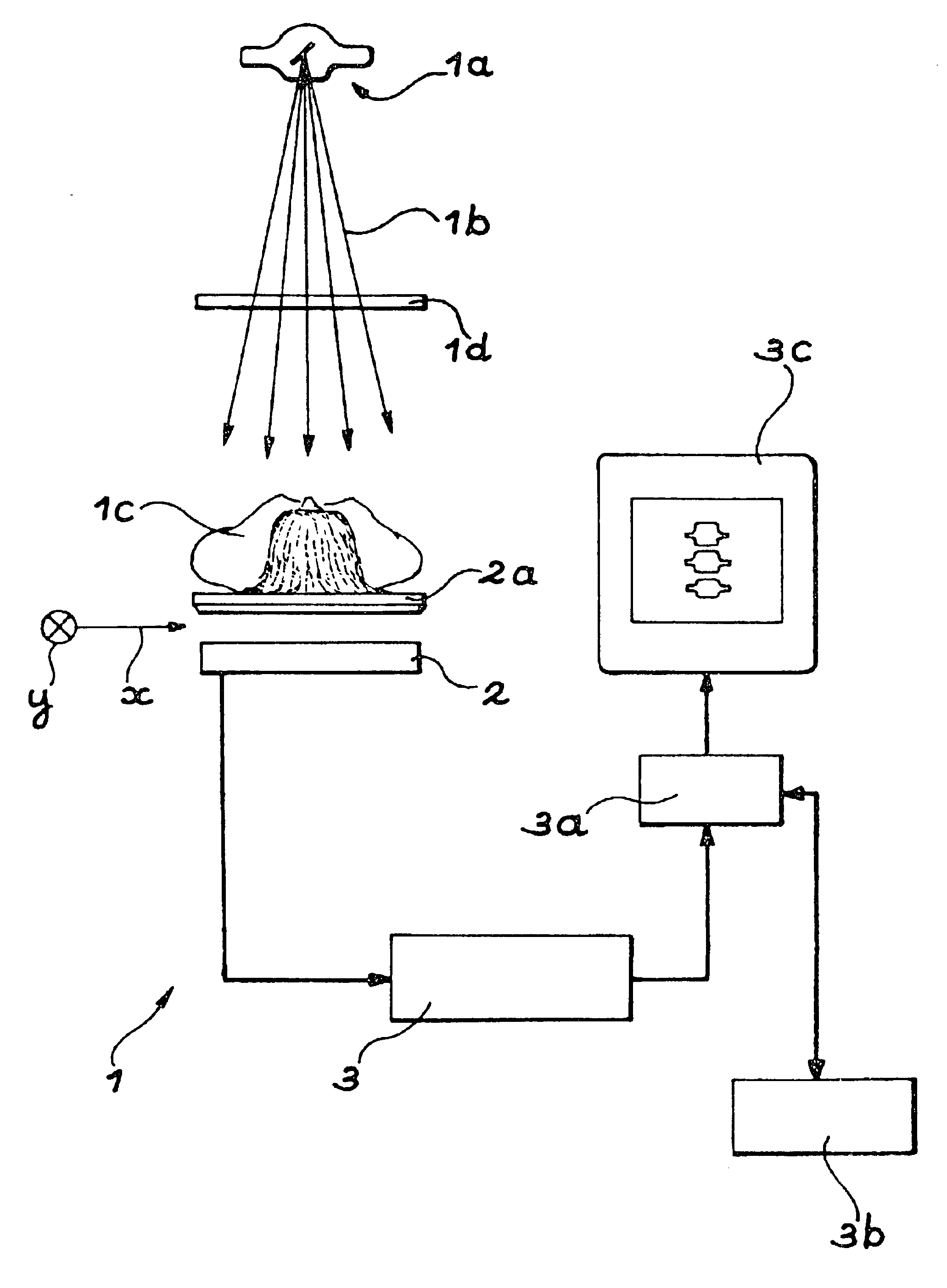 Method for using a bone densitometry system, with dual-energy x-radiation