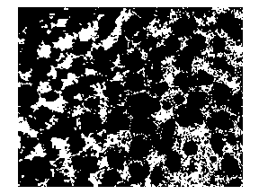 Preparation method of medical implant material porous niobium