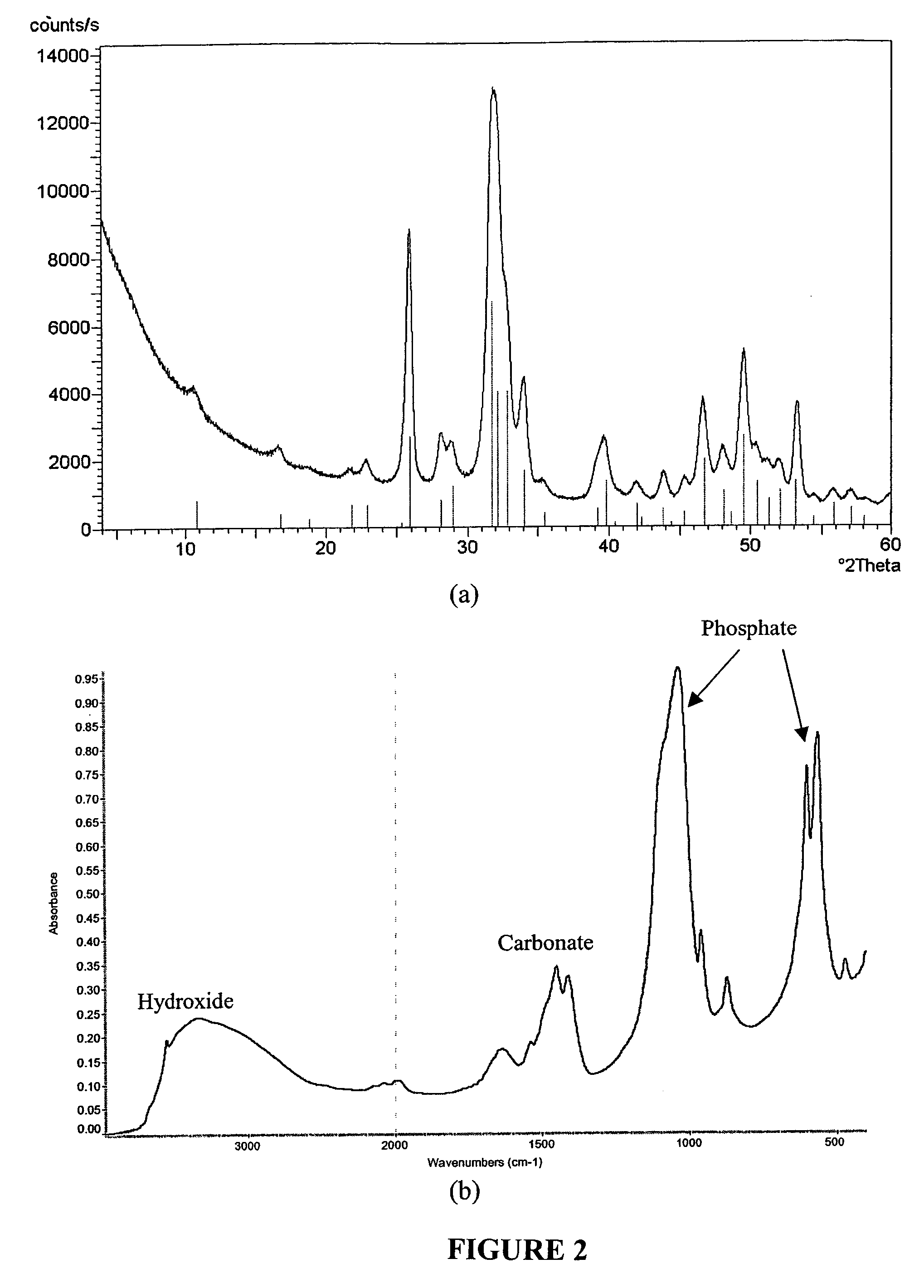 Suspension of calcium phosphate particulates for local delivery of therapeutic agents