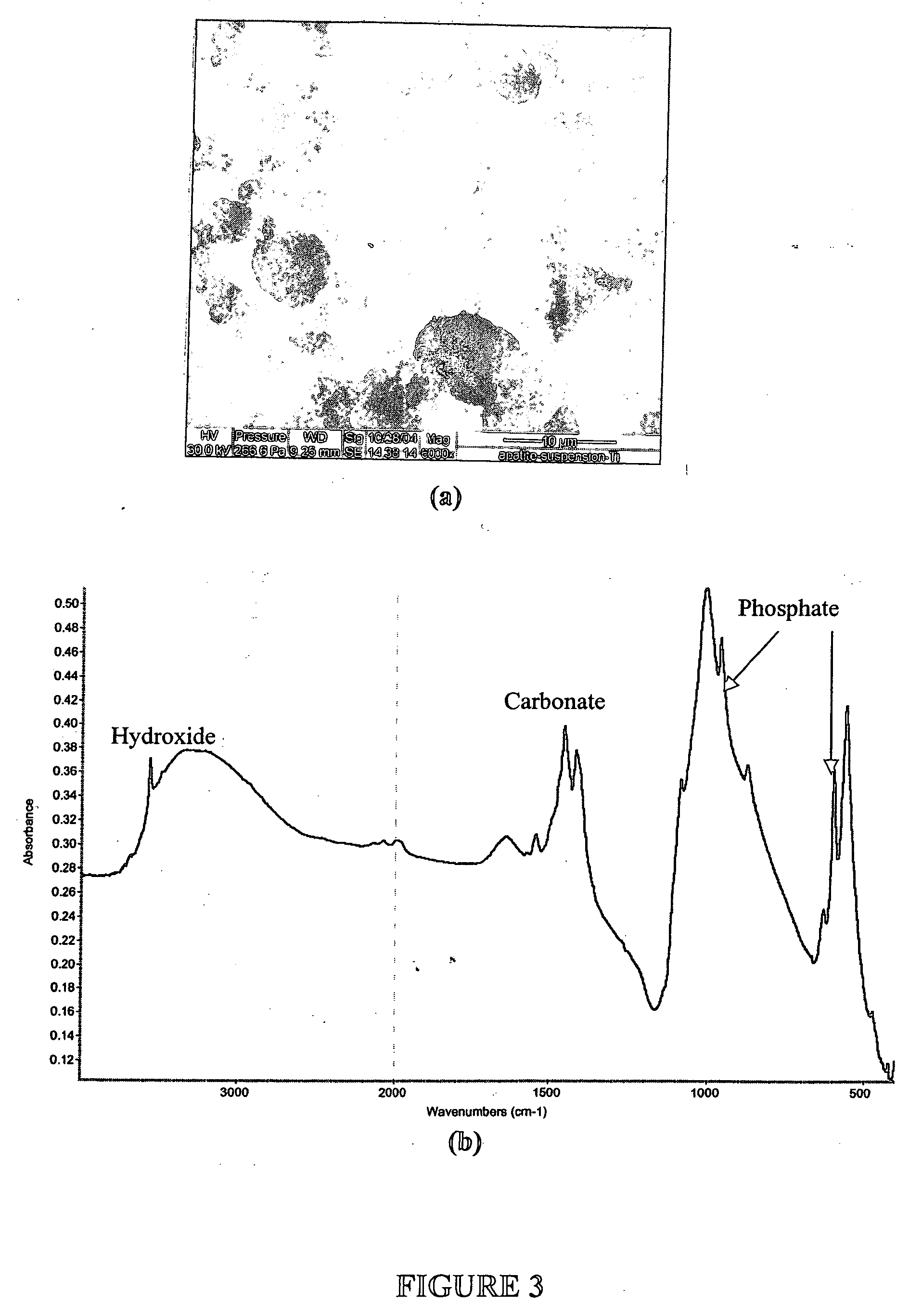 Suspension of calcium phosphate particulates for local delivery of therapeutic agents