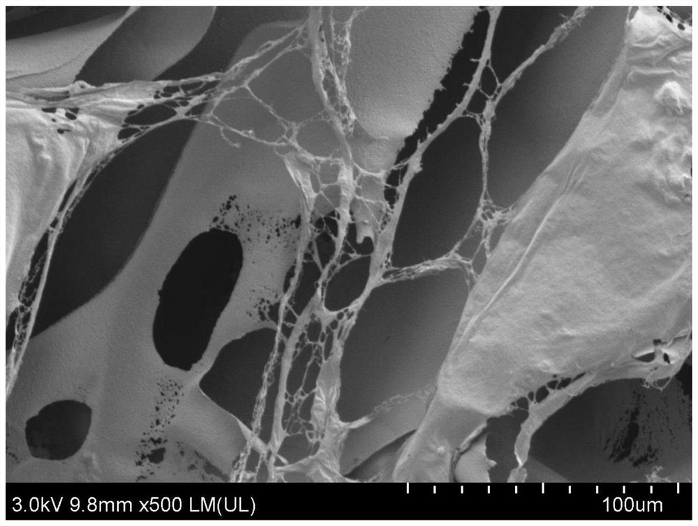 Preparation method and application of controllable multi-level cross-linked injectable thermally induced phase change hydrogel