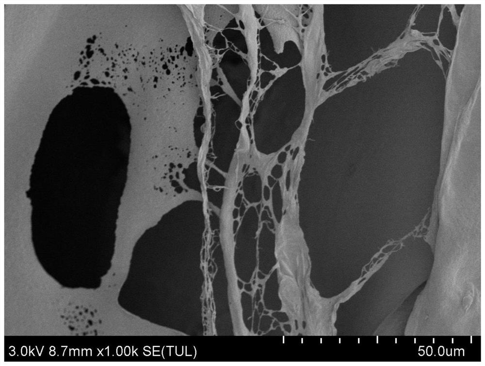 Preparation method and application of controllable multi-level cross-linked injectable thermally induced phase change hydrogel