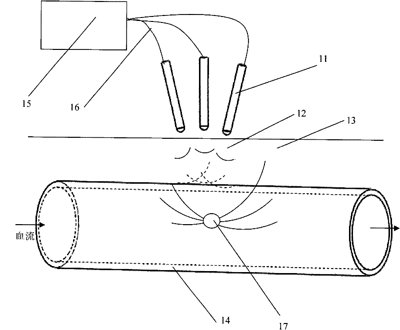 Wearable multi-field radiation whole-body hyperthermia device