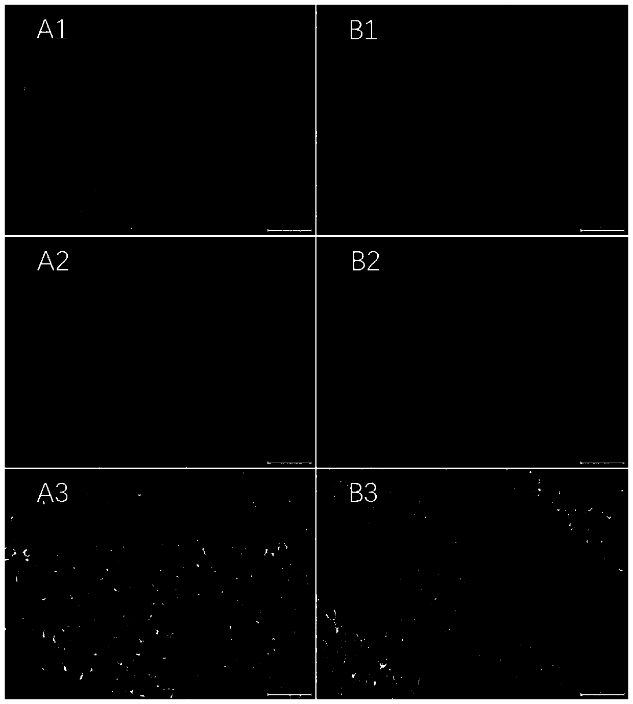 Glial fibrillary acidic protein (GFAP) antibody detection test kit, and application thereof