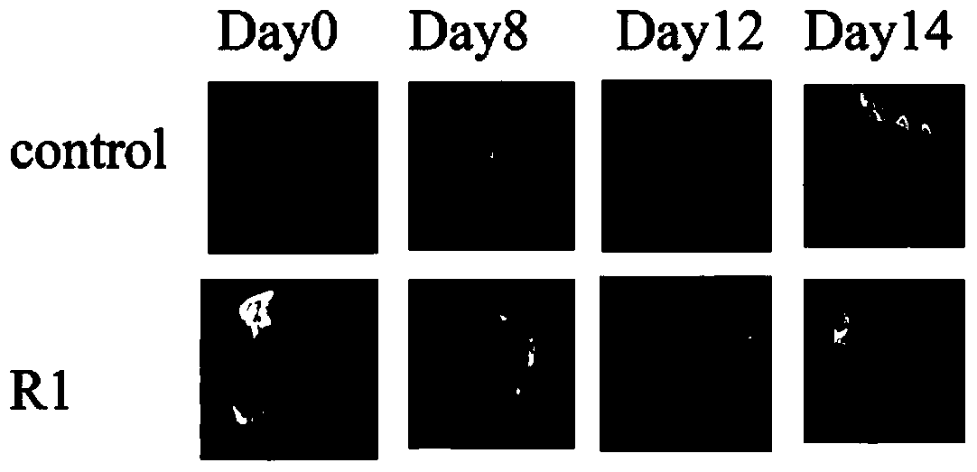 Medicinal use of notoginseng saponin r1