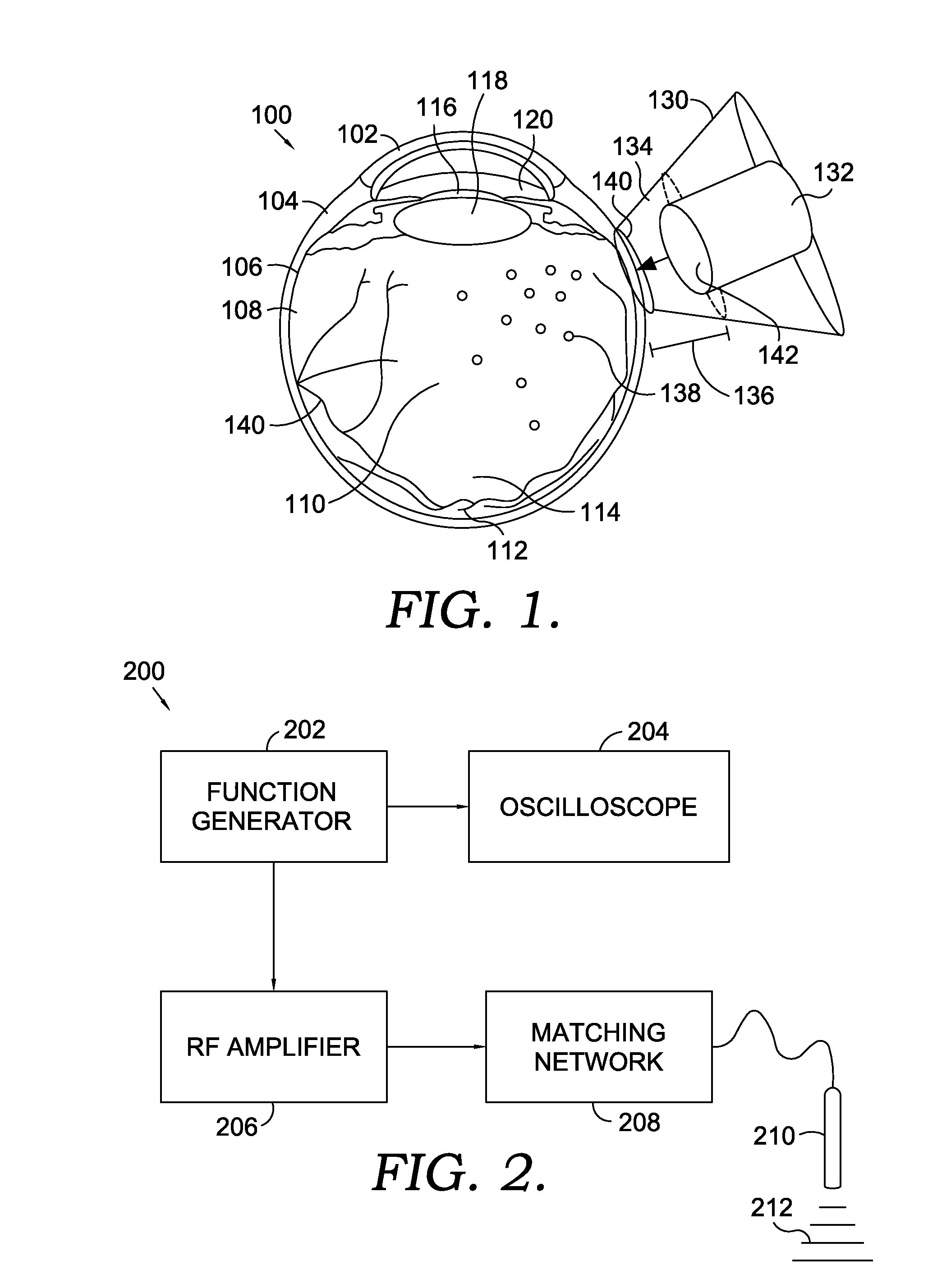 Ultrasound-Mediated Transcleral Drug Delivery