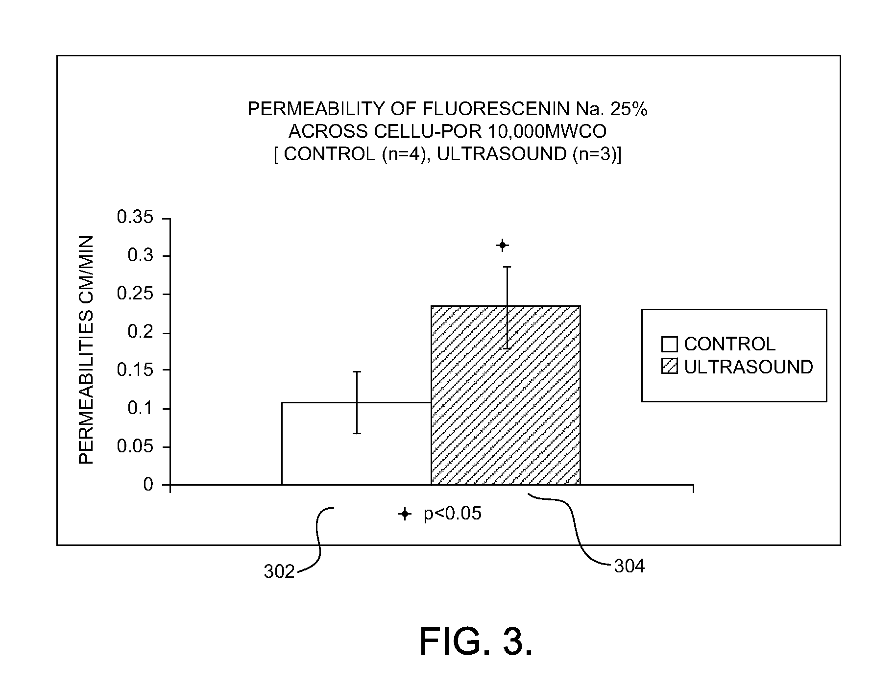 Ultrasound-Mediated Transcleral Drug Delivery