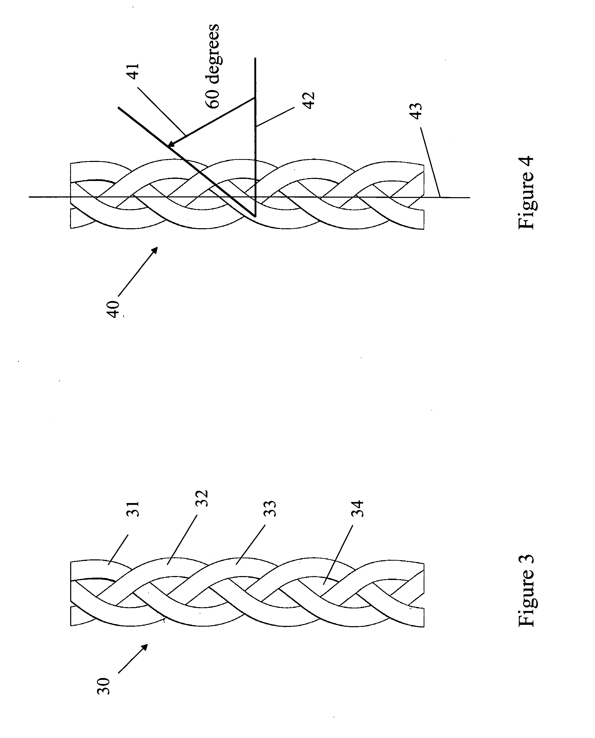 Elastic metallic replacement ligament