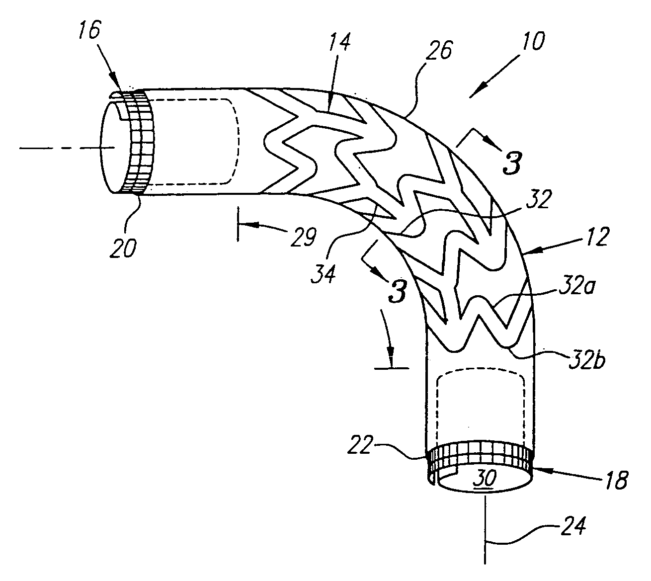 Coiled-sheet stent-graft with slidable exo-skeleton