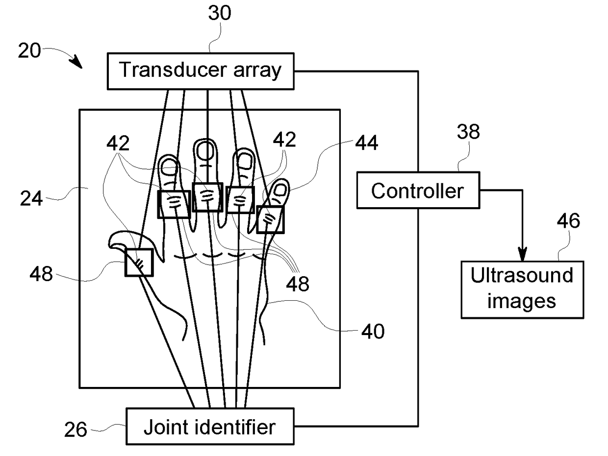 Auto finger joint detection for robotic hand ultrasound scanner