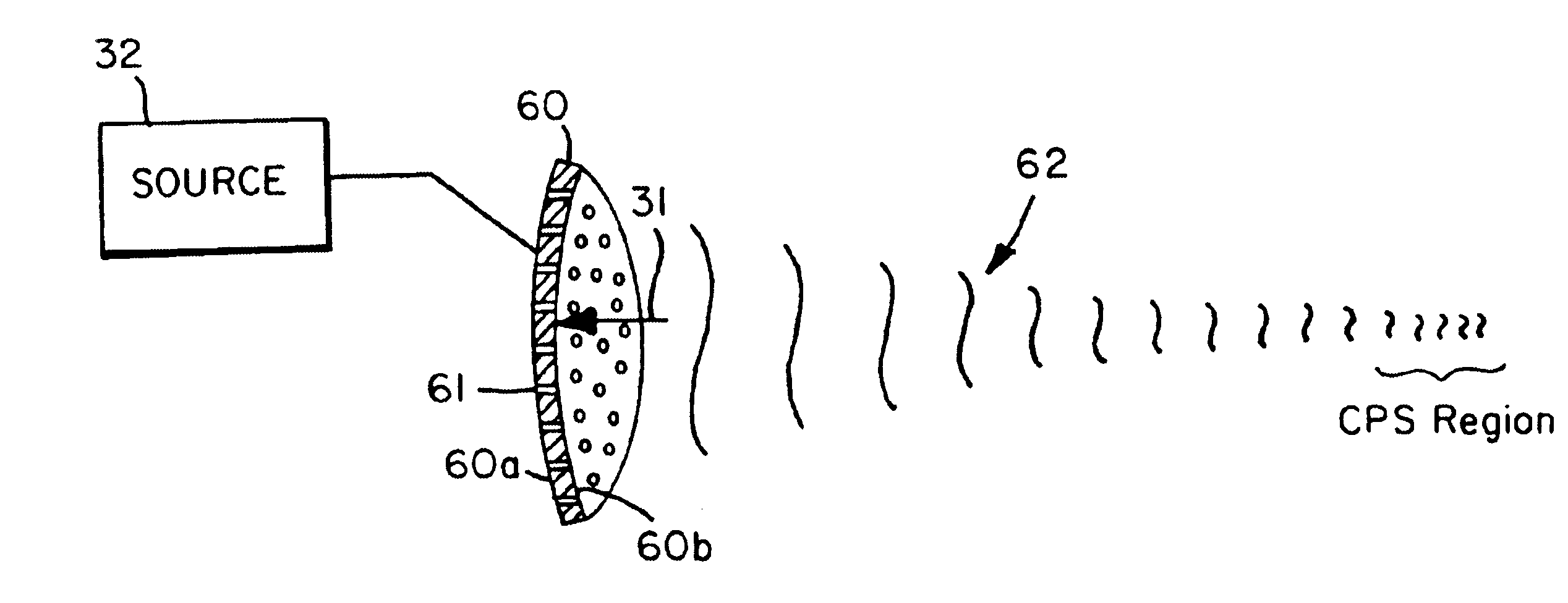 Method and apparatus for acoustic suppression of cavitation