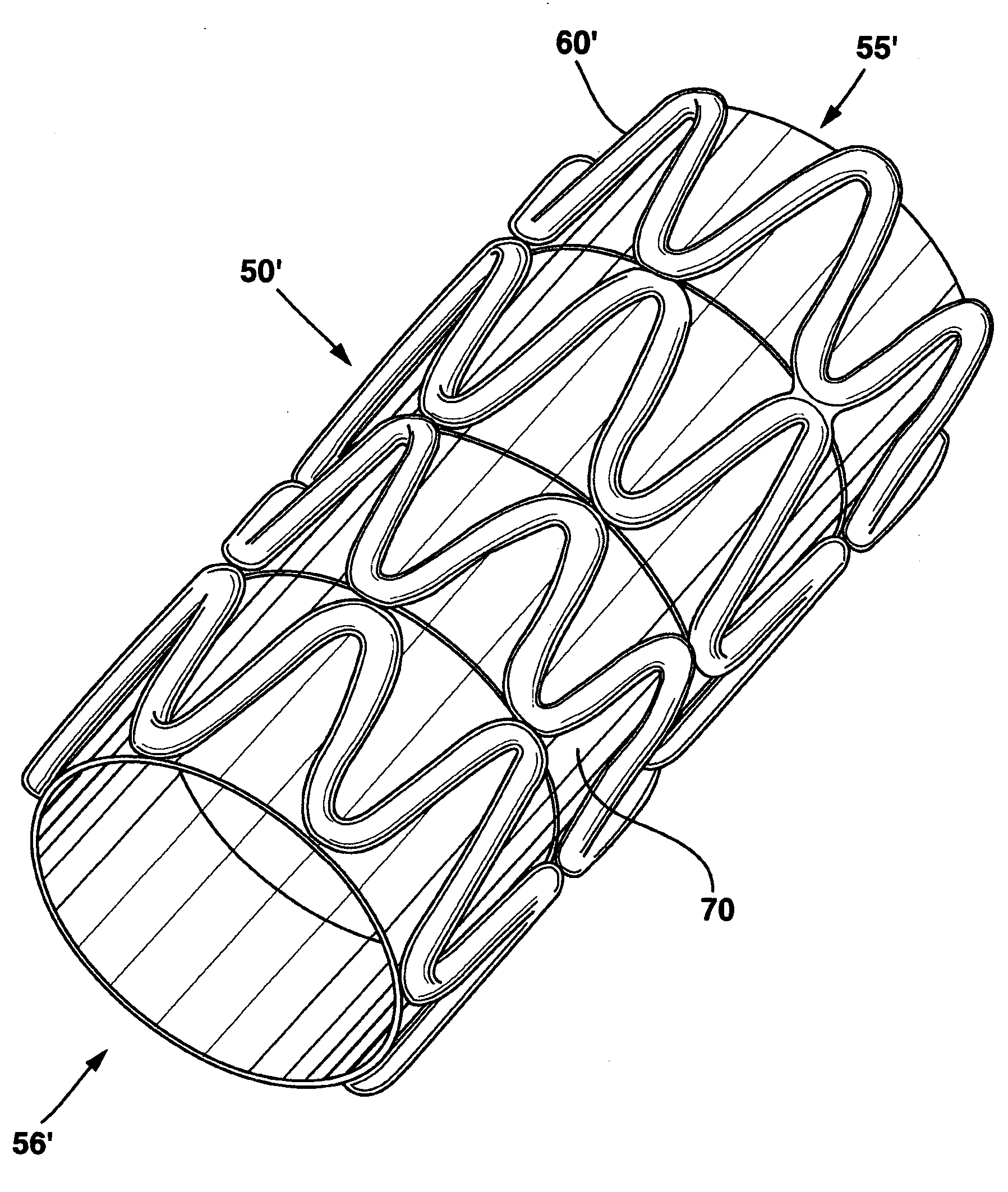 Modulated stents and methods of making the stents