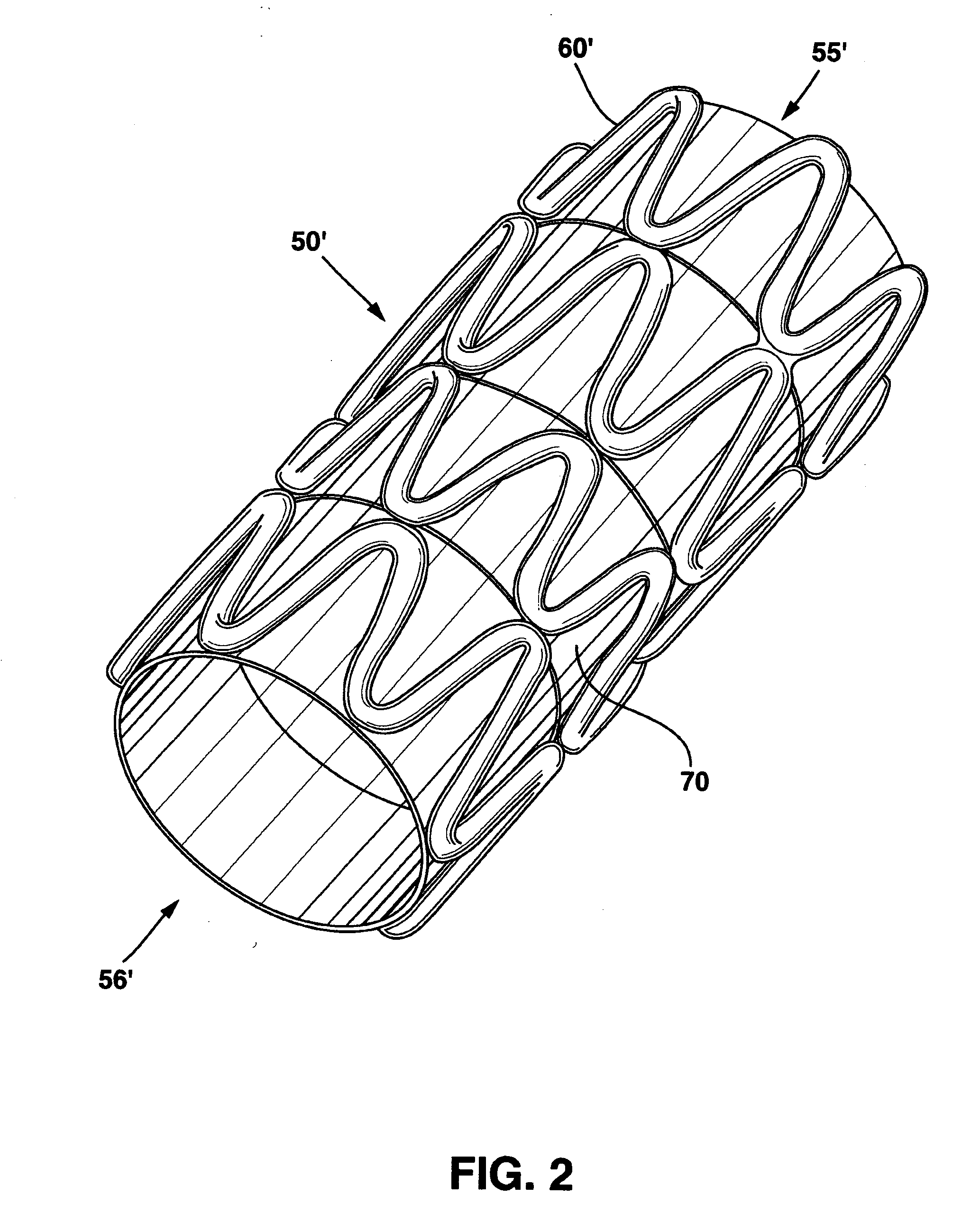 Modulated stents and methods of making the stents