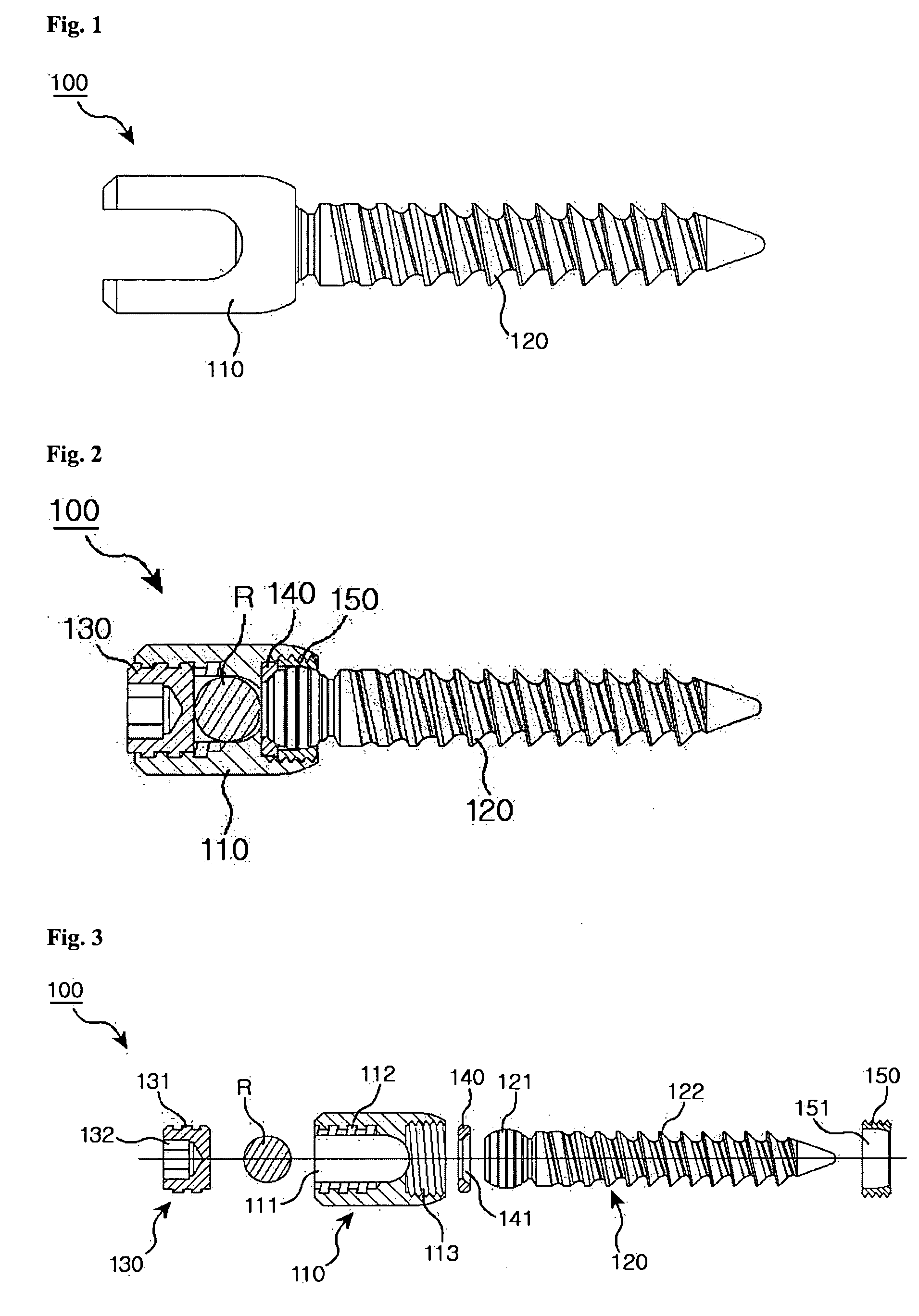 Spinal pedicle screw assembly