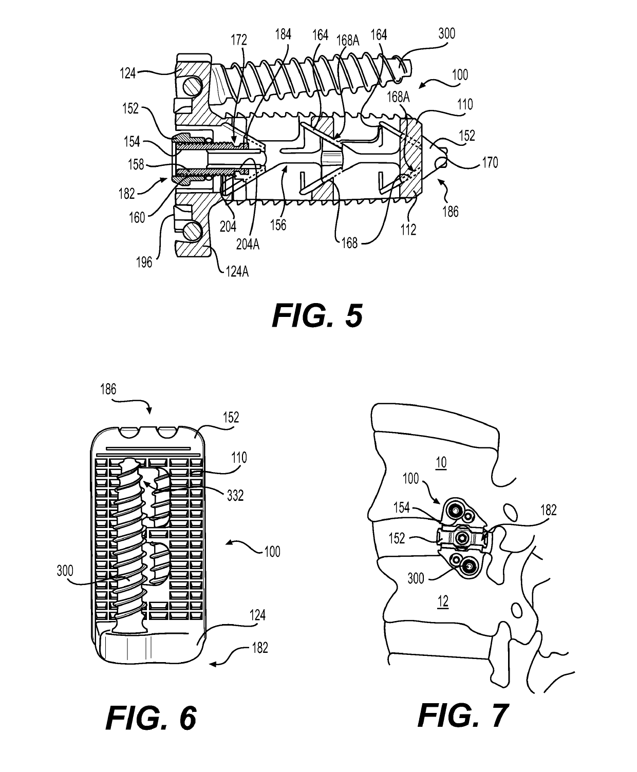 Expandable vertebral implant