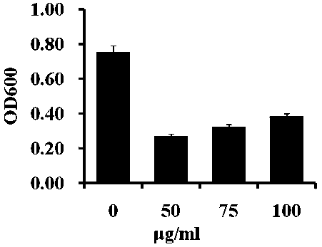 Application of perylene tetracarboxylic dianhydride amidation compound in anti-staphylococcus aureus