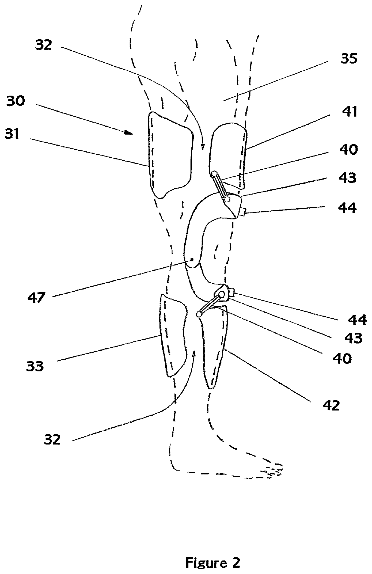 Exoskeleton chassis