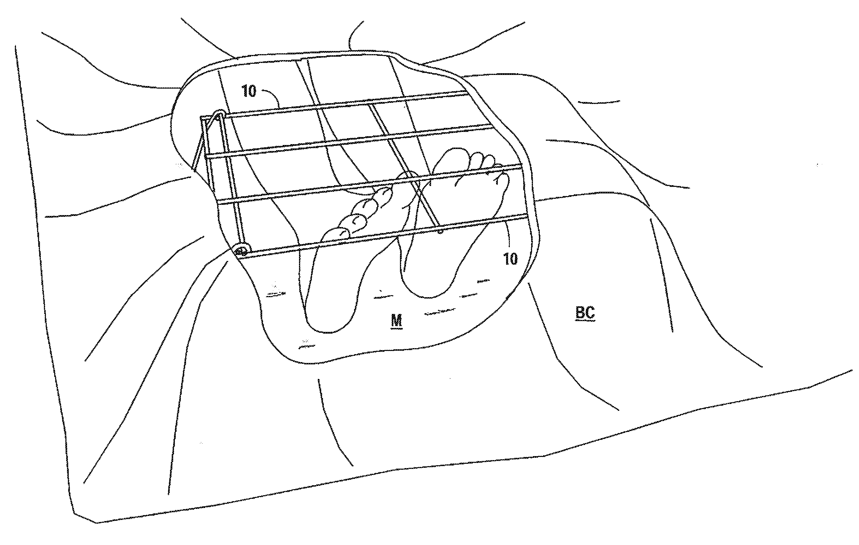 Folding foot protection device for a bedded patient