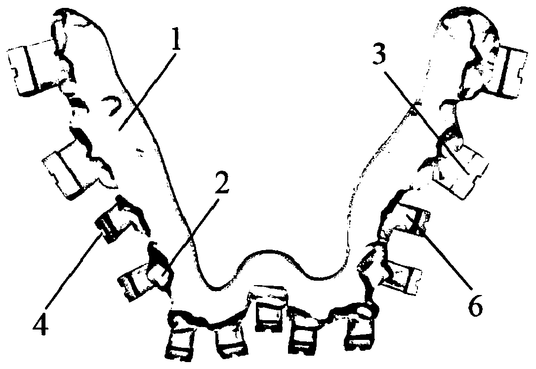 Positioning device for guiding bonding of labial brackets and manufacturing method of positioning device