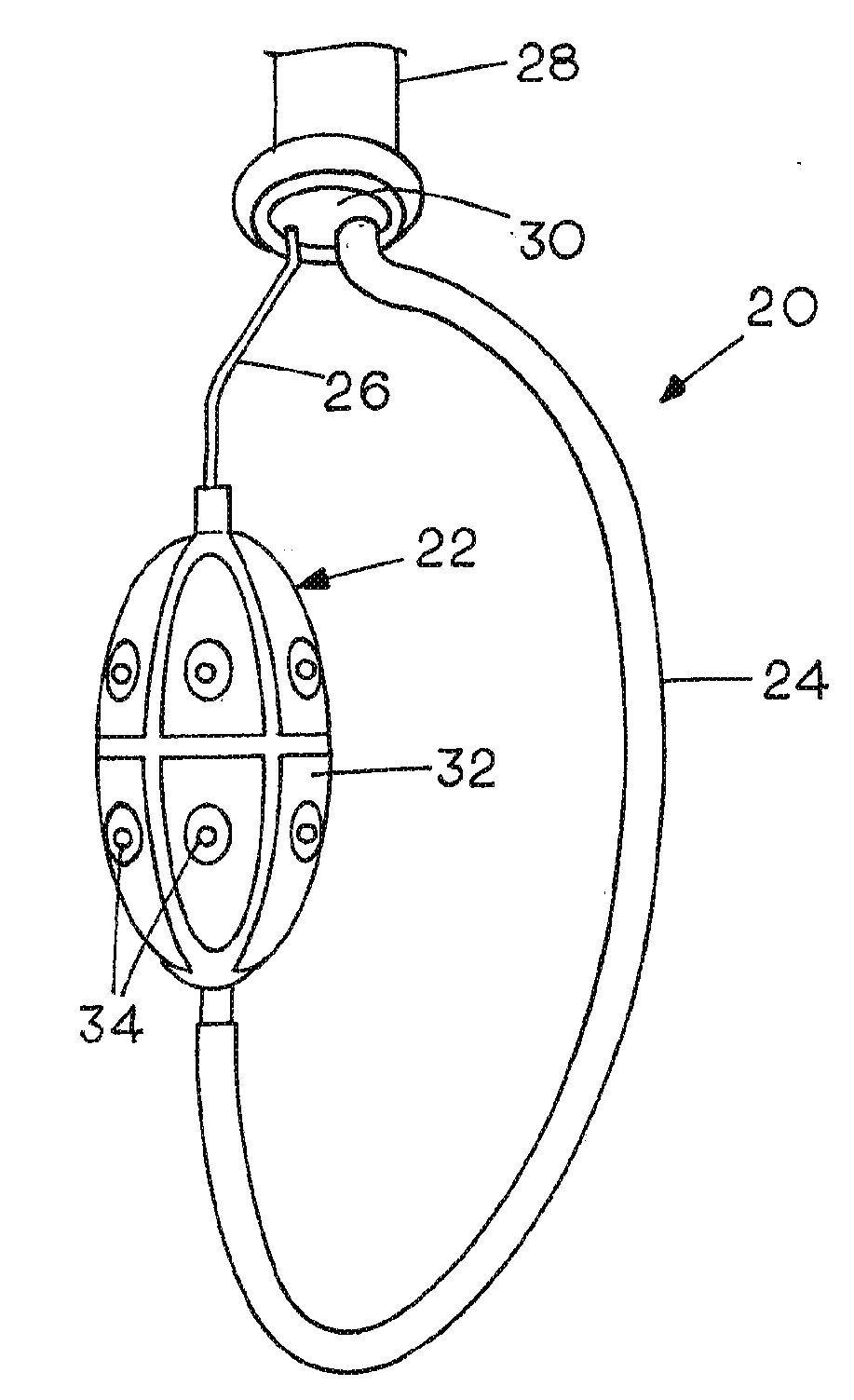 Catheter Systems for Cardiac Arrhythmia Ablation