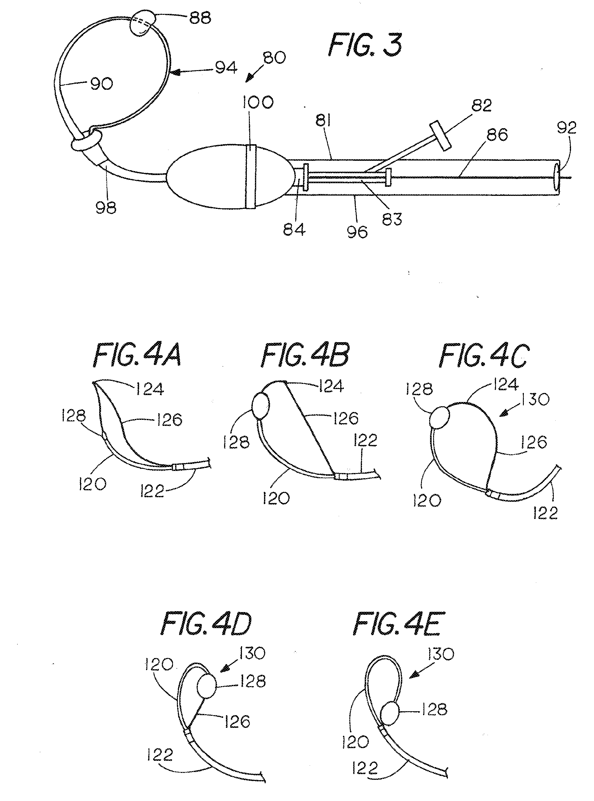 Catheter Systems for Cardiac Arrhythmia Ablation