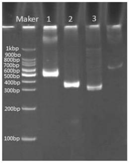 Genetic typing detection primer group related to cardiovascular and cerebrovascular disease drugs, kit and detection method