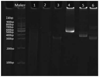 Genetic typing detection primer group related to cardiovascular and cerebrovascular disease drugs, kit and detection method