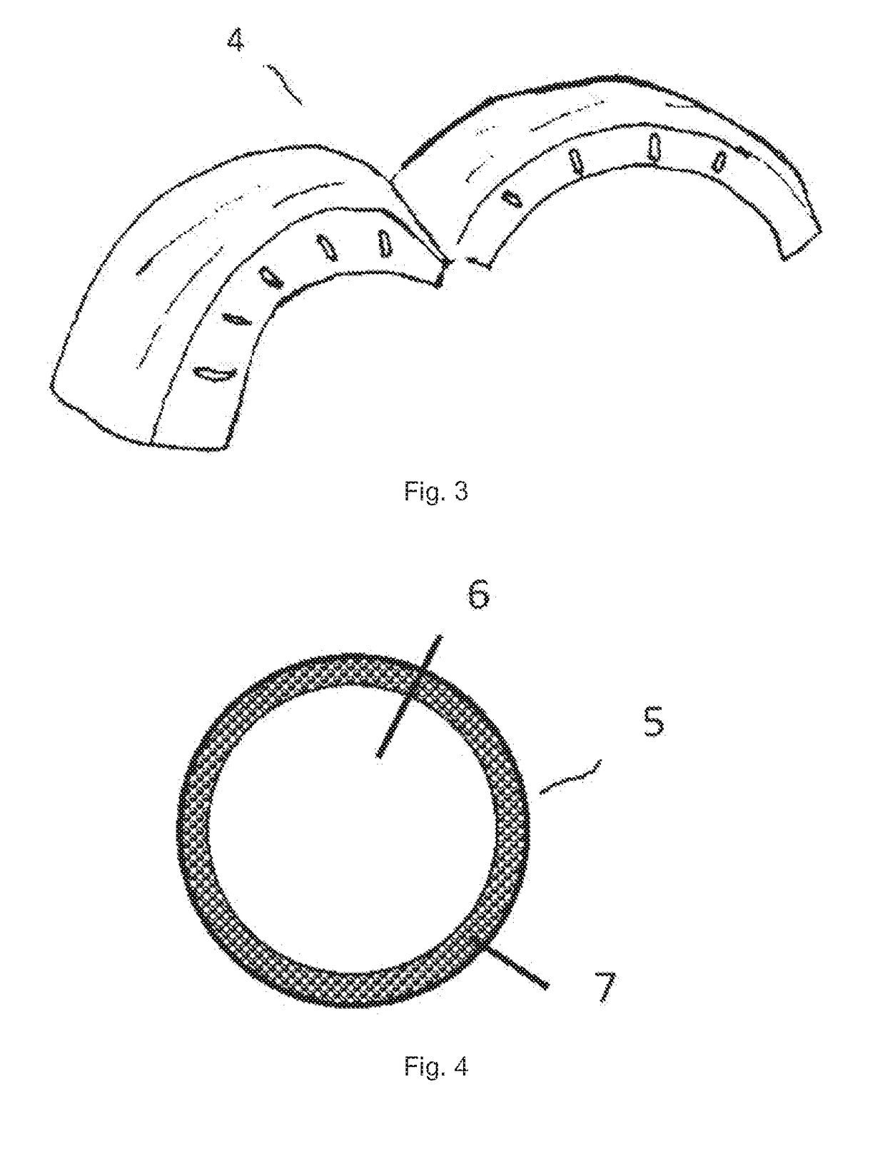 Wheel arch liner for a vehicle