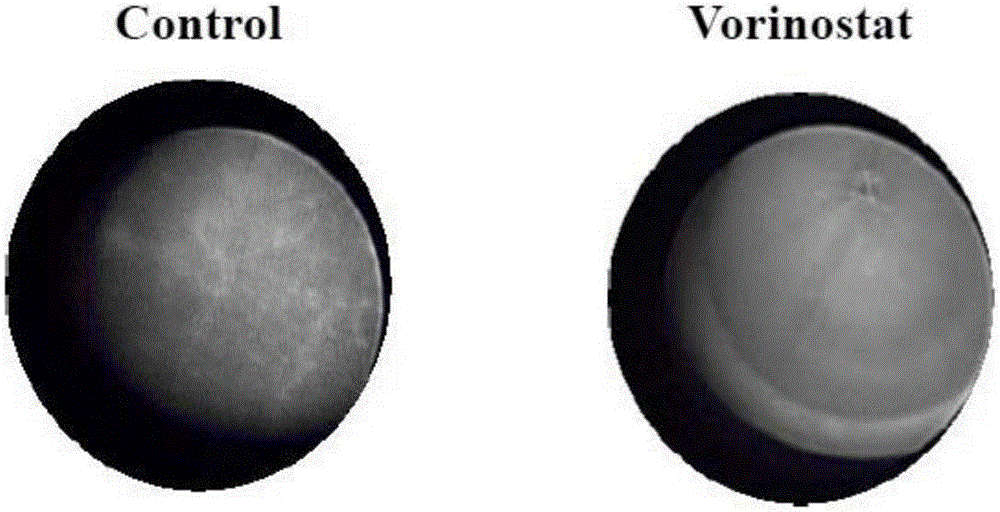 Application of vorinostat for preparation of immunomodulatory drugs