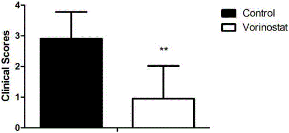 Application of vorinostat for preparation of immunomodulatory drugs