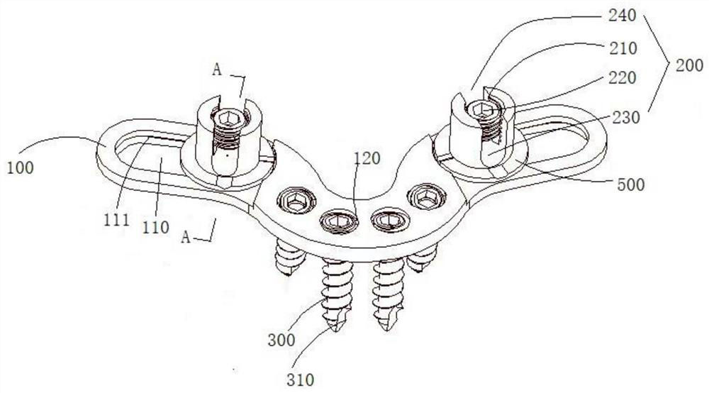 A locking occipital plate with adjustable width