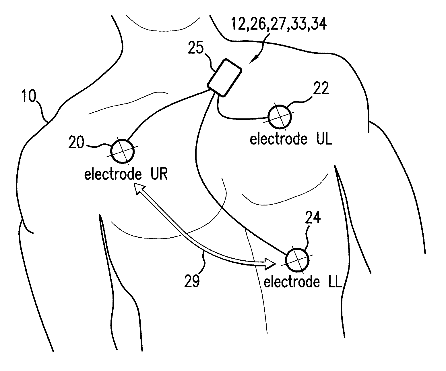 Body-worn monitor for measuring respiratory rate