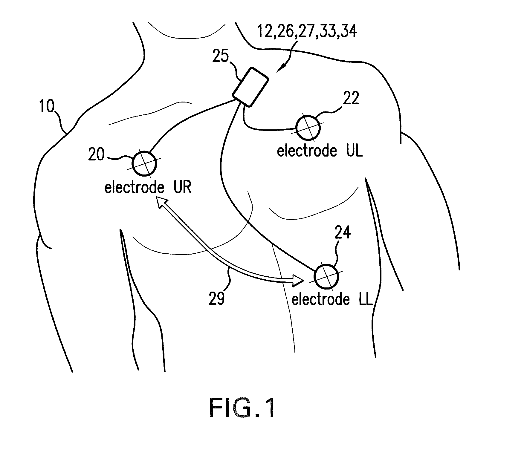 Body-worn monitor for measuring respiratory rate