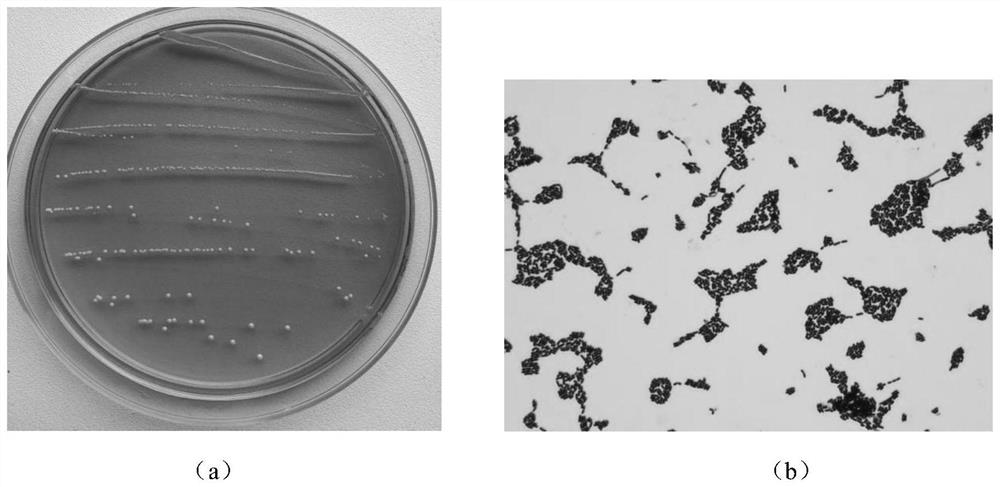 Lactobacillus plantarum s58 and its application in the preparation of products for alleviating obesity