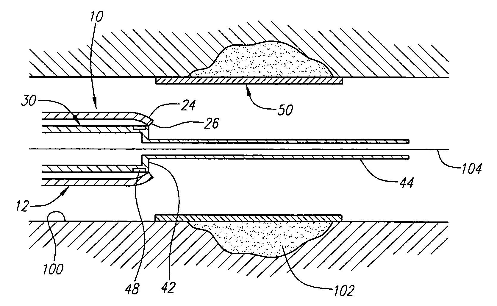 Apparatus for delivering endoluminal prostheses and methods of making and using them