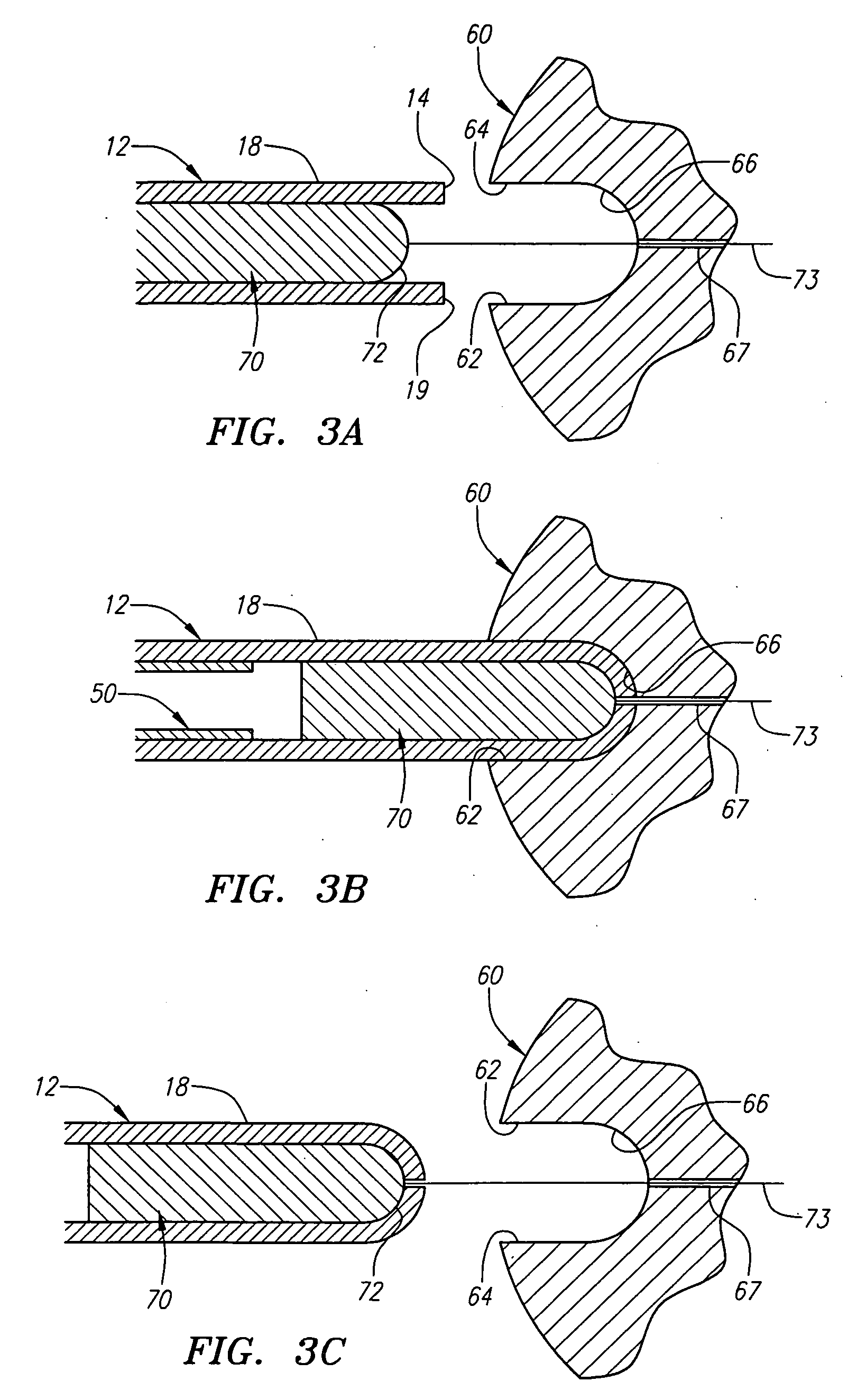 Apparatus for delivering endoluminal prostheses and methods of making and using them